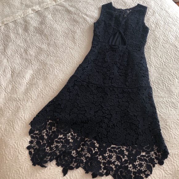 Navy Blue Joie Lace Dress - Picture 2 of 4